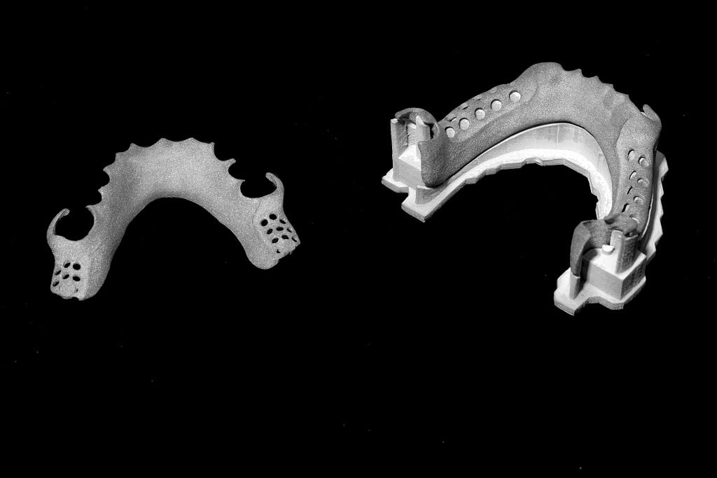 3D Printing Metals for Orthopedic Implants Application